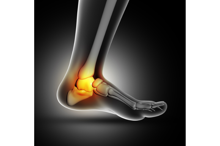 Foot & Ankle Pain
